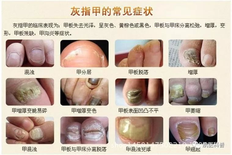 微信(xin)圖片_20191122103308.jpg 微信(xin)圖片_20191122103308.jpg